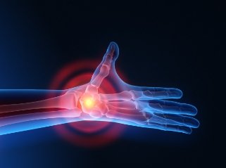 Chirurgie du poignet